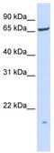 Phosphatidylinositol Glycan Anchor Biosynthesis Class T antibody, TA341990, Origene, Western Blot image 