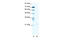 Transient Receptor Potential Cation Channel Subfamily M Member 3 antibody, 28-564, ProSci, Western Blot image 