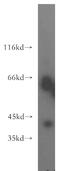 Translocation Associated Membrane Protein 2 antibody, 13311-1-AP, Proteintech Group, Western Blot image 
