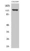 Adenylate Cyclase 1 antibody, STJ91394, St John