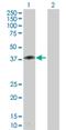 Zinc Finger Protein 396 antibody, H00252884-D01P, Novus Biologicals, Western Blot image 