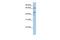 Dihydrolipoamide S-Acetyltransferase antibody, GTX47092, GeneTex, Western Blot image 