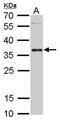 Pim-2 Proto-Oncogene, Serine/Threonine Kinase antibody, GTX113928, GeneTex, Western Blot image 