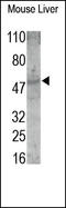 Interstitial collagenase A antibody, 250750, Abbiotec, Western Blot image 