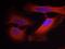 Keratin 8 antibody, GTX50320, GeneTex, Immunofluorescence image 