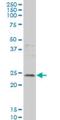 Grancalcin antibody, H00025801-M01, Novus Biologicals, Western Blot image 