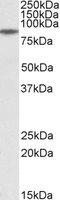 Gamma-Glutamyl Carboxylase antibody, LS-B10319, Lifespan Biosciences, Western Blot image 