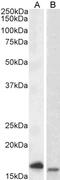 Nicotinamide N-Methyltransferase antibody, 43-628, ProSci, Western Blot image 