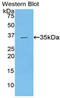 TAFI antibody, LS-C296604, Lifespan Biosciences, Western Blot image 