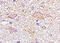 Fibroblast Growth Factor Receptor 4 antibody, 250653, Abbiotec, Immunohistochemistry paraffin image 