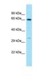 Luteinizing Hormone/Choriogonadotropin Receptor antibody, orb331116, Biorbyt, Western Blot image 