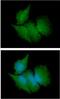 Carbonyl Reductase 3 antibody, GTX57565, GeneTex, Immunocytochemistry image 