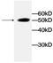 Lactate Dehydrogenase A antibody, abx018063, Abbexa, Enzyme Linked Immunosorbent Assay image 