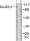 Glutamate Ionotropic Receptor AMPA Type Subunit 2 antibody, PA5-38105, Invitrogen Antibodies, Western Blot image 