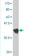 Solute Carrier Family 6 Member 5 antibody, H00009152-M01, Novus Biologicals, Western Blot image 