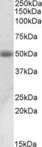 Acid Phosphatase, Prostate antibody, NBP1-78280, Novus Biologicals, Western Blot image 