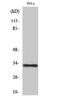 Olfactory Receptor Family 10 Subfamily AD Member 1 antibody, A17523, Boster Biological Technology, Western Blot image 