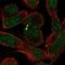 Senataxin antibody, NBP2-13300, Novus Biologicals, Immunofluorescence image 