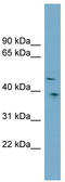 SPARC (Osteonectin), Cwcv And Kazal Like Domains Proteoglycan 3 antibody, TA335971, Origene, Western Blot image 