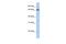 Zinc Finger Protein 136 antibody, A14700, Boster Biological Technology, Western Blot image 