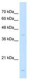 Lectin, Mannose Binding 2 antibody, TA341862, Origene, Western Blot image 