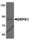 SRSF Protein Kinase 1 antibody, 8435, ProSci, Western Blot image 