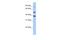 Methyltransferase Like 2B antibody, A13876, Boster Biological Technology, Western Blot image 