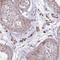 Zinc Finger Protein 35 antibody, NBP2-30820, Novus Biologicals, Immunohistochemistry paraffin image 