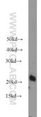 Anti-Silencing Function 1A Histone Chaperone antibody, 22259-1-AP, Proteintech Group, Western Blot image 