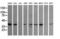 Mitogen-Activated Protein Kinase Kinase 3 antibody, LS-C174527, Lifespan Biosciences, Western Blot image 