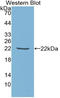 TIMP Metallopeptidase Inhibitor 1 antibody, LS-C314188, Lifespan Biosciences, Western Blot image 
