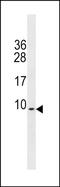 Phosphodiesterase 6H antibody, PA5-49248, Invitrogen Antibodies, Western Blot image 