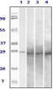 RAB25, Member RAS Oncogene Family antibody, abx011140, Abbexa, Enzyme Linked Immunosorbent Assay image 