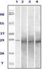 Ras-related protein Rab-25 antibody, abx011140, Abbexa, Enzyme Linked Immunosorbent Assay image 