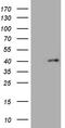 Forkhead Box R1 antibody, M15179, Boster Biological Technology, Western Blot image 