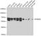 Ribosomal Protein S6 Kinase B2 antibody, GTX66013, GeneTex, Western Blot image 