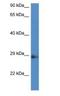 N(Alpha)-Acetyltransferase 11, NatA Catalytic Subunit antibody, NBP1-91327, Novus Biologicals, Western Blot image 