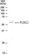 Pleiotropic Regulator 1 antibody, NB100-853, Novus Biologicals, Western Blot image 