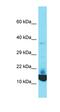 Family With Sequence Similarity 25 Member E antibody, orb326974, Biorbyt, Western Blot image 