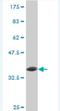 Ubiquitin Protein Ligase E3A antibody, H00007337-M02, Novus Biologicals, Western Blot image 