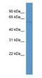 Selenoprotein N antibody, NBP1-69058, Novus Biologicals, Western Blot image 