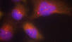 Neurotrophic Receptor Tyrosine Kinase 2 antibody, abx000469, Abbexa, Western Blot image 