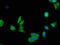 Lactate Dehydrogenase A antibody, LS-C211152, Lifespan Biosciences, Immunofluorescence image 