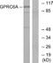 G Protein-Coupled Receptor Class C Group 6 Member A antibody, A30829, Boster Biological Technology, Western Blot image 