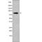 ArfGAP With Coiled-Coil, Ankyrin Repeat And PH Domains 1 antibody, PA5-64529, Invitrogen Antibodies, Western Blot image 