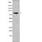 Arf-GAP with coiled-coil, ANK repeat and PH domain-containing protein 1 antibody, PA5-64529, Invitrogen Antibodies, Western Blot image 