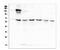 AKT Serine/Threonine Kinase 2 antibody, M00725-1, Boster Biological Technology, Western Blot image 