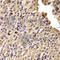 Chaperonin Containing TCP1 Subunit 4 antibody, A6548, ABclonal Technology, Immunohistochemistry paraffin image 