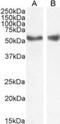 Nuclear Receptor Subfamily 1 Group H Member 3 antibody, NB100-1465, Novus Biologicals, Western Blot image 