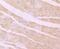 Desmoglein 2 antibody, NBP2-75469, Novus Biologicals, Immunohistochemistry paraffin image 